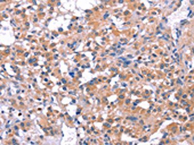 ELP2 Antibody