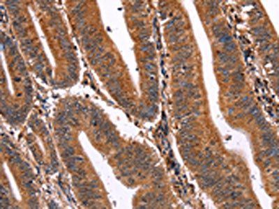ELP2 Antibody