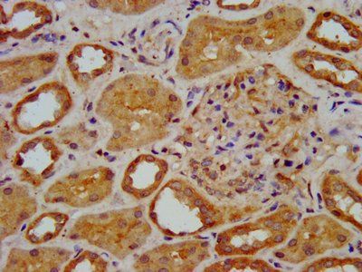 ELP3 Antibody