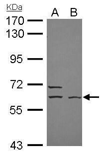 ELP3 Rabbit Polyclonal Antibody