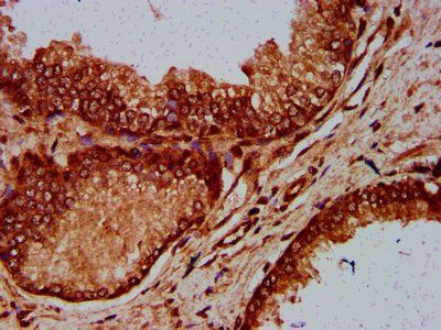 ELP4 Antibody