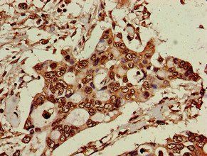 ELP6 Antibody