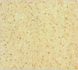 EME1 Antibody