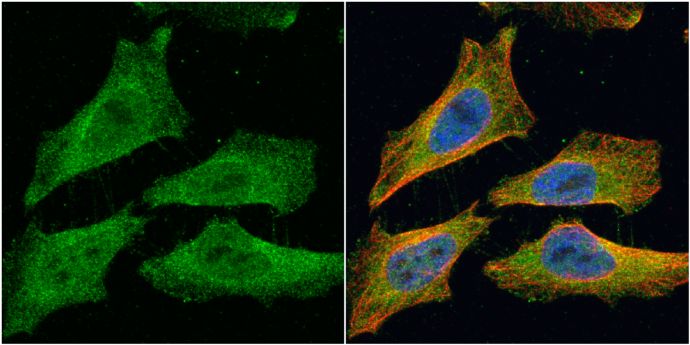 EML1 antibody