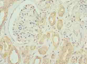 EMP1 Antibody