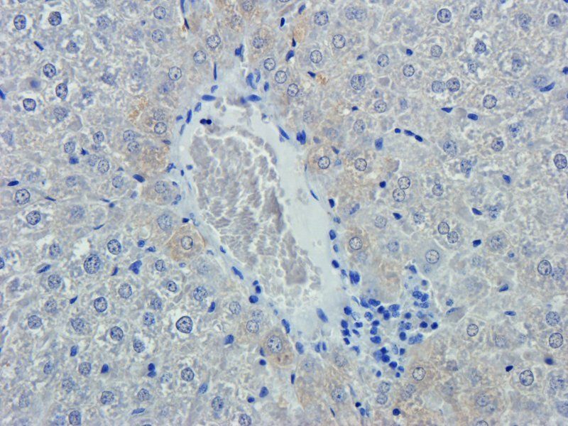 Emp1 antibody