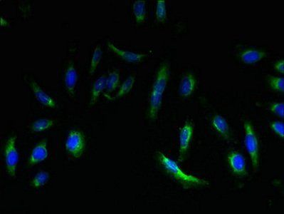 EMP3 Antibody