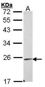 Endomucin Rabbit Polyclonal Antibody