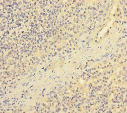 Endothelial cell-selective adhesion molecule antibody