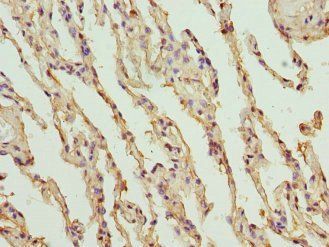PROCR Antibody