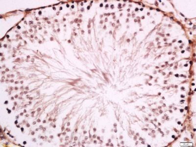 Endothelial lipase antibody