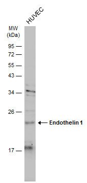 Endothelin 1 antibody