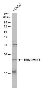 Endothelin 1 antibody [C1C3]