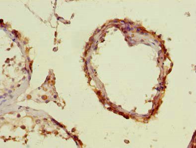 ENKD1 antibody