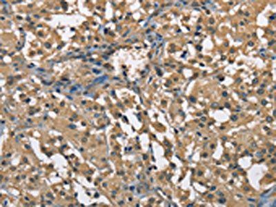 ENO1 Antibody