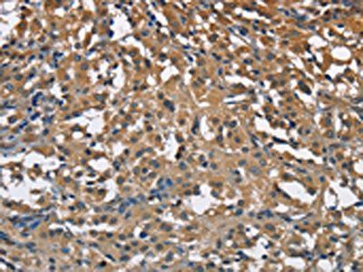 ENO1 Antibody