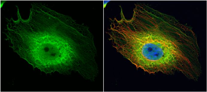 ENO1 antibody [N3C3]