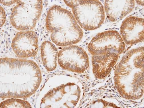 ENO1 Rabbit Polyclonal Antibody
