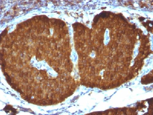 NSE gamma (Neuron Specific Enolase, gamma) (Neuroendocrine Marker) Antibody