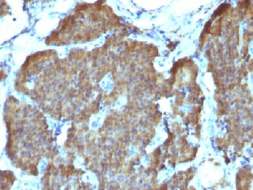 NSE gamma (Neuron Specific Enolase, gamma) (Neuroendocrine Marker) Antibody