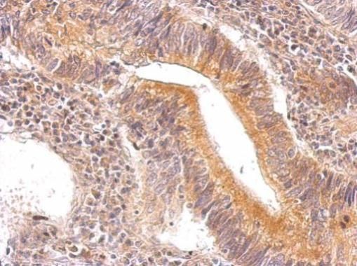 ENO3 antibody