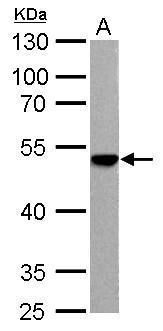 ENO3 Rabbit Polyclonal Antibody