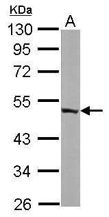 ENO3 Rabbit Polyclonal Antibody