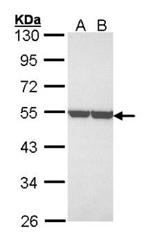 enolase 1 antibody