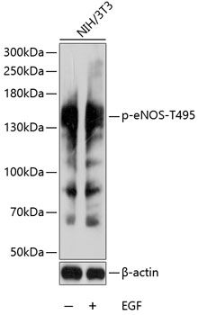 eNOS (Phospho-T495) antibody