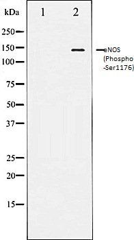 eNOS (Phospho-Ser1176) antibody