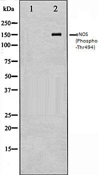eNOS (Phospho-Thr494) antibody
