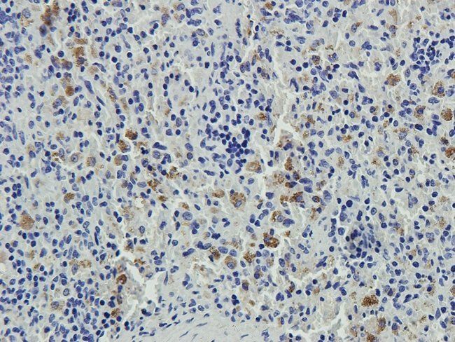 ENPP1 antibody