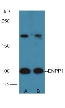 ENPP1 antibody
