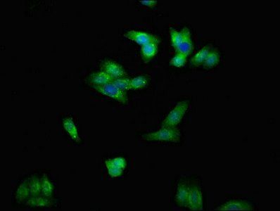 ENPP1 antibody