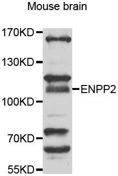 ENPP2 antibody