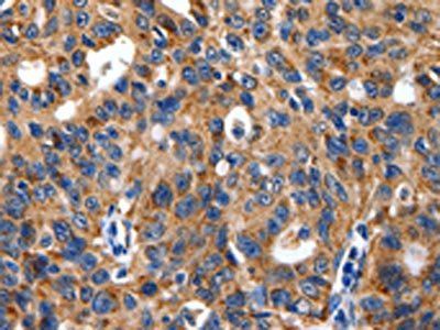 ENPP3 Antibody