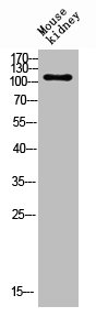 ENPP3 antibody