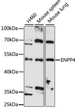 ENPP4 antibody