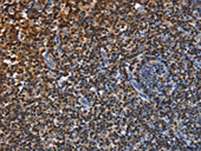 ENPP5 Antibody