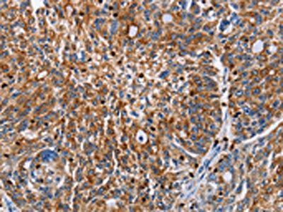 ENPP5 Antibody