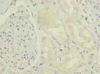 ENPP6 antibody