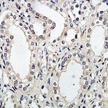 ENPP6 Rabbit Polyclonal Antibody