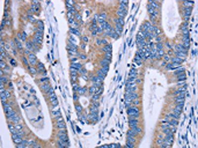 ENPP7 Antibody