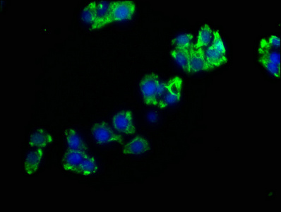 ENPP7 antibody