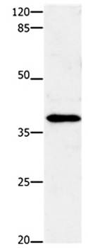 ENPP7 Antibody