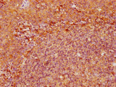 ENTPD1 Antibody