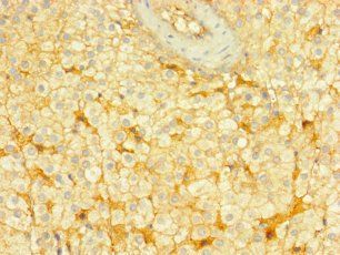 ENTPD3 Antibody