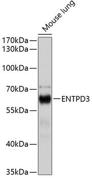 ENTPD3 antibody