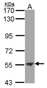 ENTPD3 Rabbit Polyclonal Antibody
