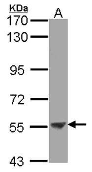 ENTPD3 antibody